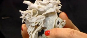 3D Printer Used To Save Life Of Two-Year-Old